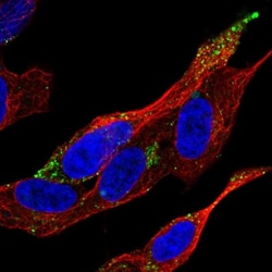 VPS37D Antibody, Novus Biologicals 25 &mu;L, Unlabeled:Antibodies, Polyclonal
